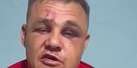 СОРВАЛИ С ГРУДИ МЕДАЛИ